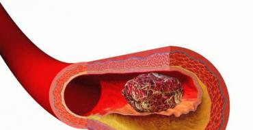 Зузаан цусны жирэмслэлтэнд үзүүлэх нөлөө: хүндрэл үүсэхээс хэрхэн сэргийлэх вэ?
