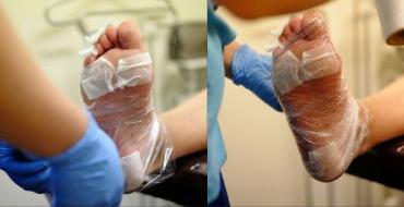 Vedel tera pediküüriks: uus toode naiste jalgade ilu jaoks Vedel raseerija kontsadele