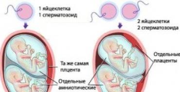 Gravidanza con gemelli: raccomandazioni dell'ostetrica-ginecologa Elena Berezovskaya